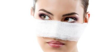 Nasenbeinbruch: Richtig erkennen und behandeln | apomio Gesundheitsblog