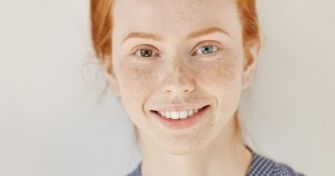 Schau mir in die Augen, Kleines! – Heterochromie und Ihre Bedeutung | apomio Gesundheitsblog