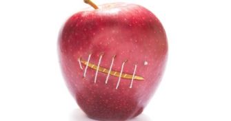 Der kleine Makel muss nicht sein: Wie man gegen Narben vorgeht | apomio Gesundheitsblog