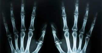 Röntgen: So funktioniert der Blick ins Innere | apomio Gesundheitsblog