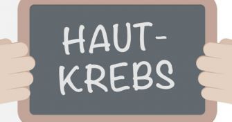 Hautkrebsarten im Überblick: Wir gut sind die Heilungschancen? | apomio Gesundheitsblog