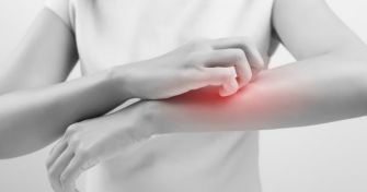 Juckreiz, Schuppen und Rötung: So äußert sich ein Hautpilz | apomio Gesundheitsblog