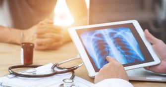 Diagnose Lungenkrebs - Wenn das Reparatursystem versagt | apomio Gesundheitsblog