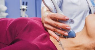 Non Hodgkin Lymphome - Krebserkrankung des lymphatischen Gewebes | apomio Gesundheitsblog