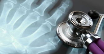 Rheumatoide Arthritis : Ursache, Verlauf und Therapie | apomio Gesundheitsblog