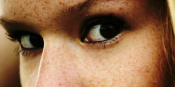 Sommersprossen: Von der Sonne geküsst | apomio Gesundheitsblog