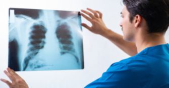 Was ist eine Trichterbrust - Symptome und Therapiemöglichkeiten | apomio Gesundheitsblog